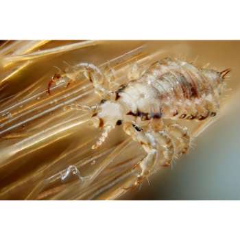 Dream Of Lice: 60 Biblical And Spiritual Meanings