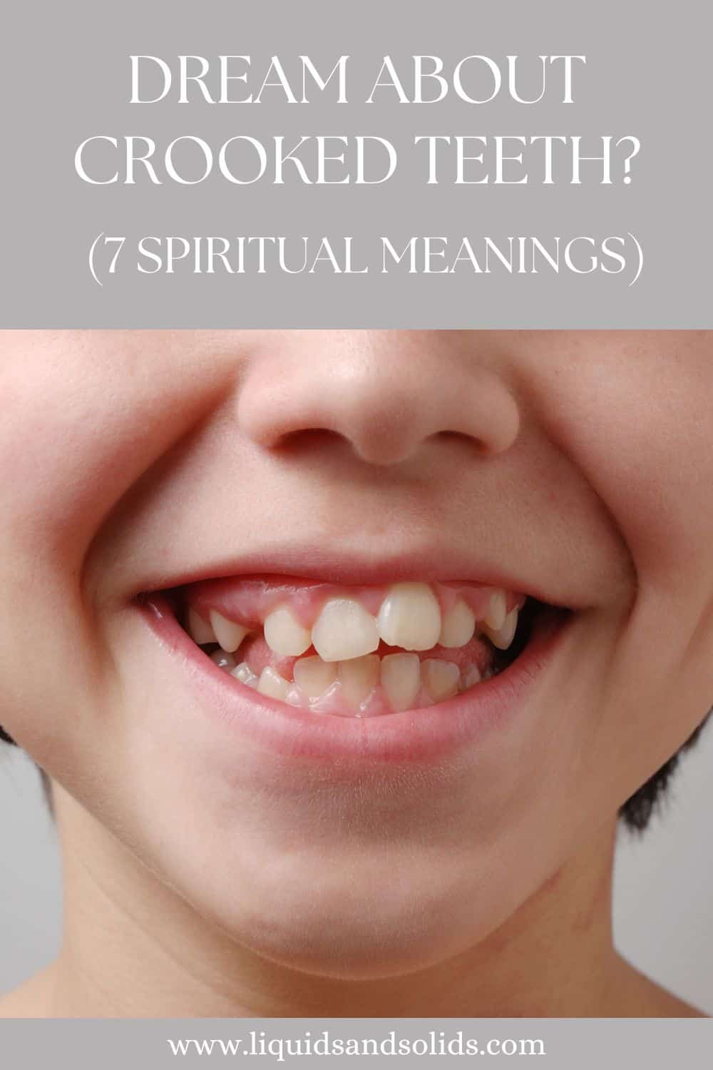 Dream About Crooked Teeth