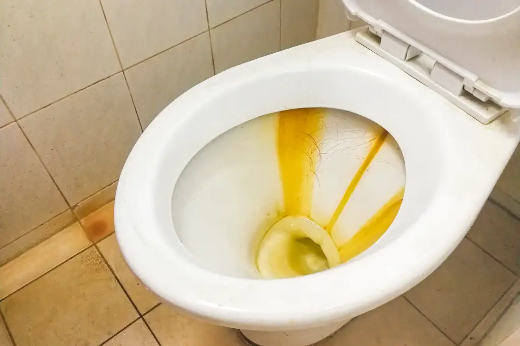 What Does It Mean to Dream About a Dirty Toilet - Everything You Need to Know