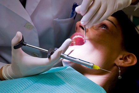 Common Causes of Dark Gums